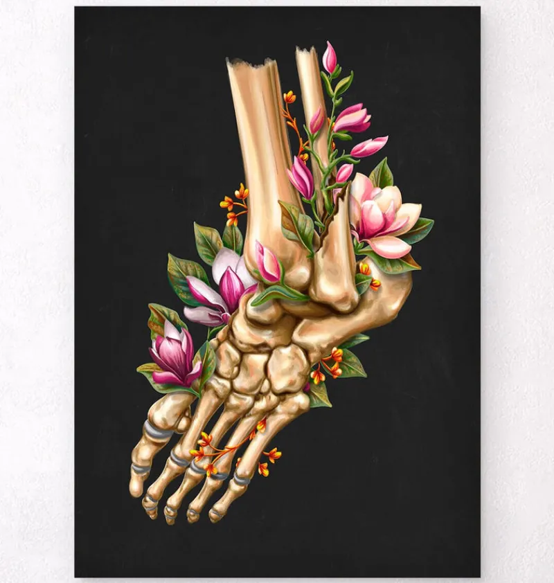 Codex Anatomicus Skull & Skeleton | Hands & Legs^Ankle fracture - Floral - Black