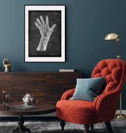 Codex Anatomicus Hands & Legs^Blood vessels of hand - Chalkboard