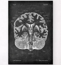 Codex Anatomicus Brain Anatomy^Brain cross section - Chalkboard