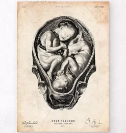 Codex Anatomicus Obstetrics & Gynecology^Fetus in a womb anatomy print II