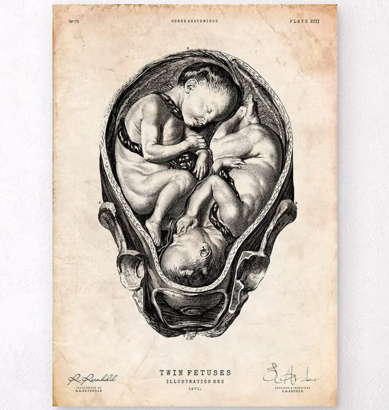 Codex Anatomicus Obstetrics & Gynecology^Fetus in a womb anatomy print II