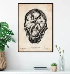 Codex Anatomicus Obstetrics & Gynecology^Fetus in a womb anatomy print II