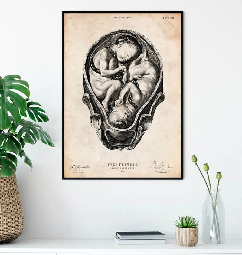 Codex Anatomicus Obstetrics & Gynecology^Fetus in a womb anatomy print II