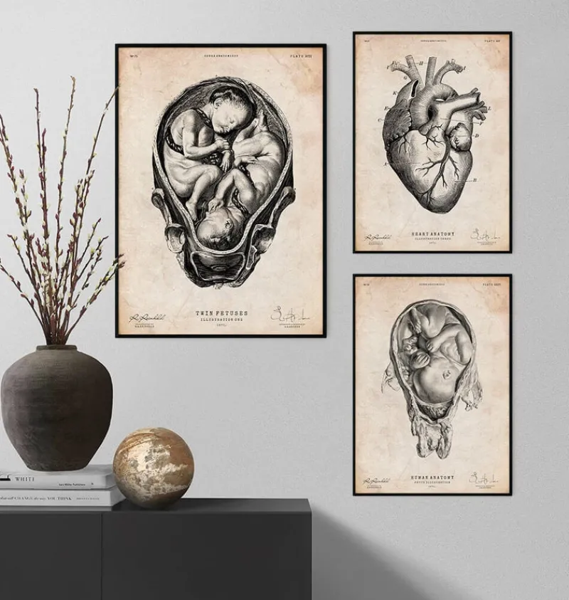 Codex Anatomicus Obstetrics & Gynecology^Fetus in a womb anatomy print II