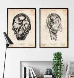 Codex Anatomicus Obstetrics & Gynecology^Fetus in a womb anatomy print