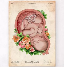 Codex Anatomicus Obstetrics & Gynecology^Fetus in a womb II - Floral - Vintage