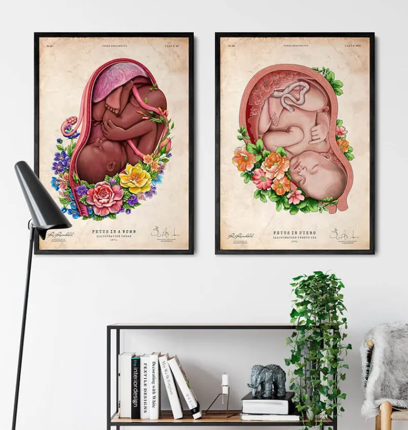 Codex Anatomicus Obstetrics & Gynecology^Fetus in a womb II - Floral - Vintage