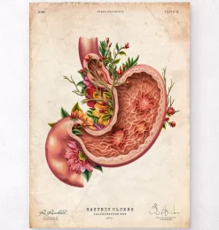 Codex Anatomicus Digestive System^Gastric ulcers - Floral - Vintage