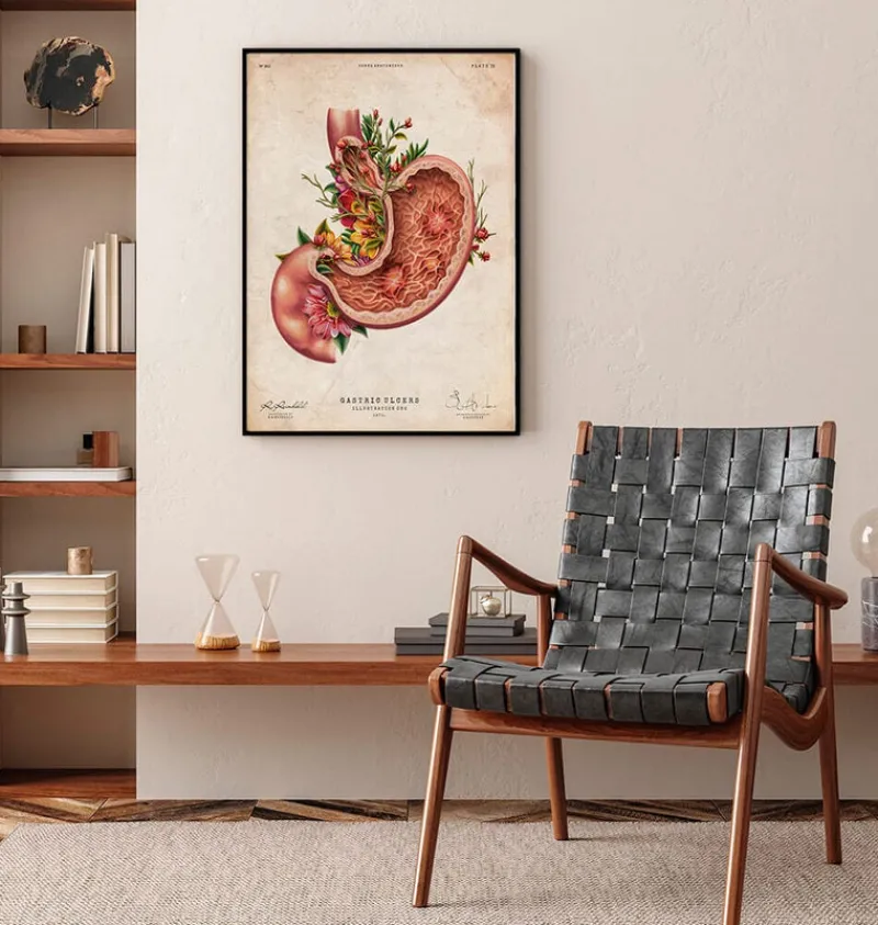 Codex Anatomicus Digestive System^Gastric ulcers - Floral - Vintage