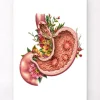 Codex Anatomicus Digestive System^Gastric ulcers - Floral - White