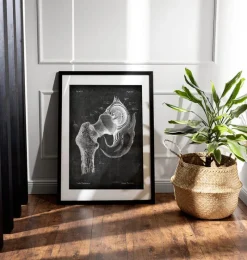 Codex Anatomicus Skull & Skeleton^Hip joint anatomy - Chalkboard