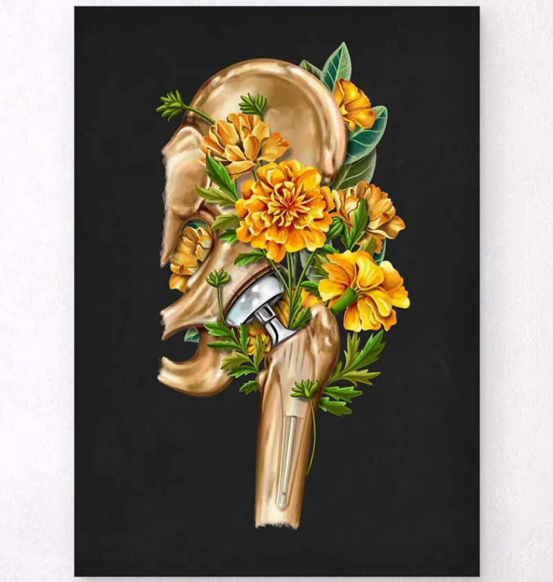 Codex Anatomicus Skull & Skeleton^Hip replacement - Floral - Black
