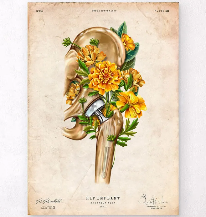 Codex Anatomicus Skull & Skeleton^Hip replacement - Floral - Vintage