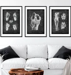 Codex Anatomicus Hands & Legs^Knee anatomy chart - Chalkboard
