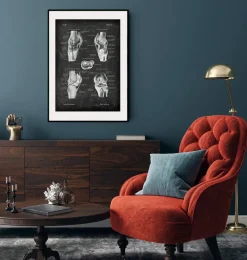 Codex Anatomicus Hands & Legs^Knee anatomy chart - Chalkboard