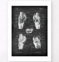 Codex Anatomicus Hands & Legs^Knee anatomy chart - Chalkboard