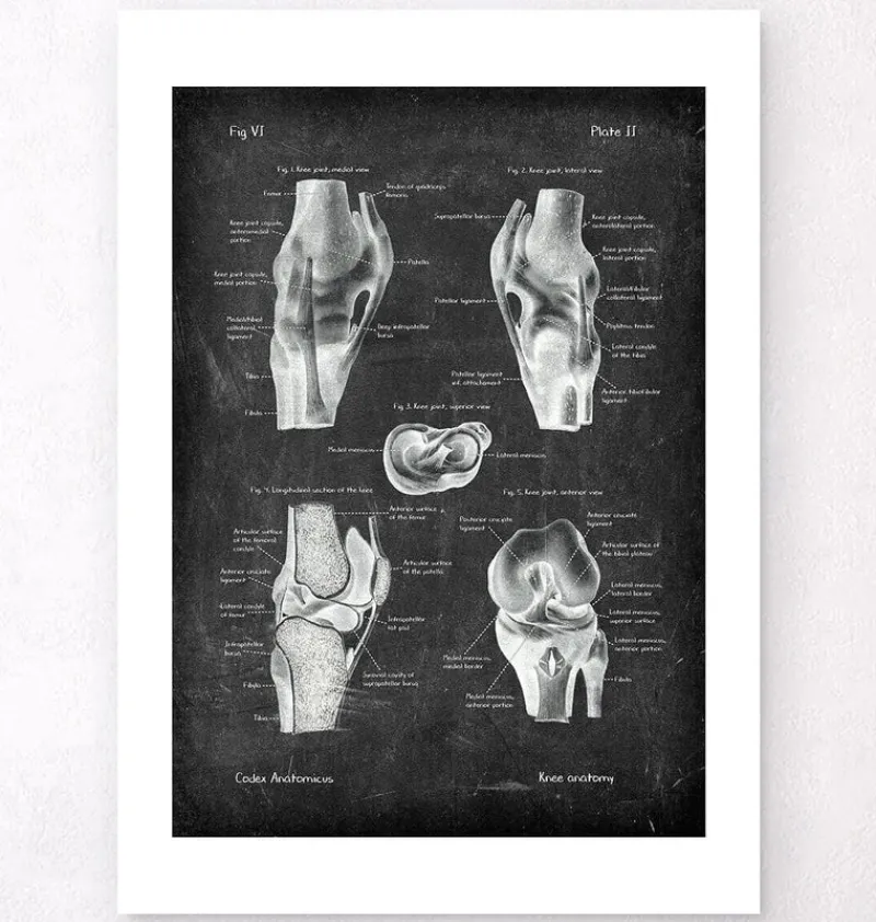Codex Anatomicus Hands & Legs^Knee anatomy chart - Chalkboard