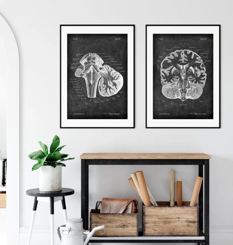 Codex Anatomicus Brain Anatomy^Medulla oblongata - Chalkboard