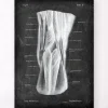 Codex Anatomicus Hands & Legs^Popliteal fossa - Chalkboard