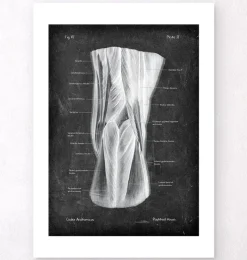 Codex Anatomicus Hands & Legs^Popliteal fossa - Chalkboard