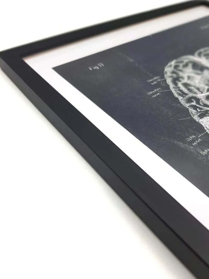 Codex Anatomicus Frames^Premium Wooden Picture Frame - 3 Colors