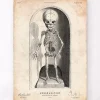 Codex Anatomicus Skull & Skeleton^Skeleton of a baby anatomy print