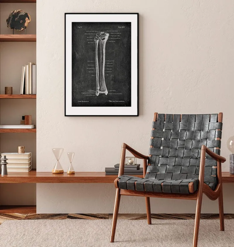 Codex Anatomicus Skull & Skeleton^Tibia & Fibula - Chalkboard