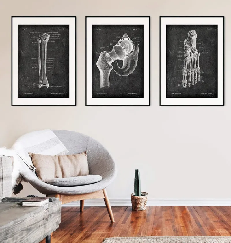 Codex Anatomicus Skull & Skeleton^Tibia & Fibula - Chalkboard