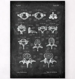 Codex Anatomicus Skull & Skeleton^Types of vertebrae - Chalkboard