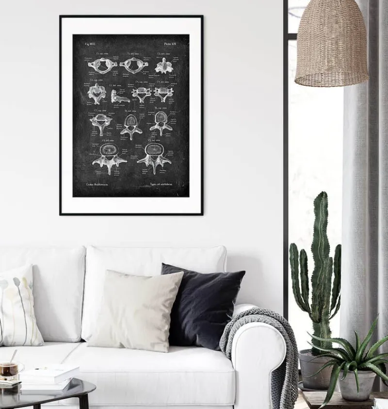 Codex Anatomicus Skull & Skeleton^Types of vertebrae - Chalkboard