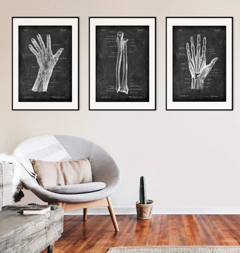 Codex Anatomicus Skull & Skeleton | Hands & Legs^Ulna & Radius - Chalkboard