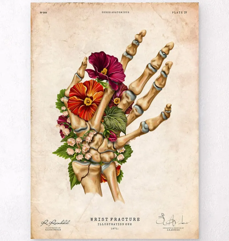 Codex Anatomicus Skull & Skeleton | Hands & Legs^Wrist fracture - Floral - Vintage